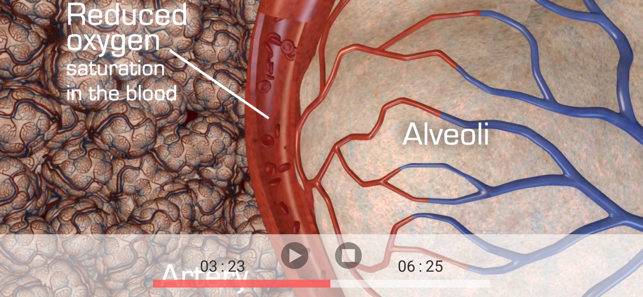 Disease 3Dme(圖2)-速報App