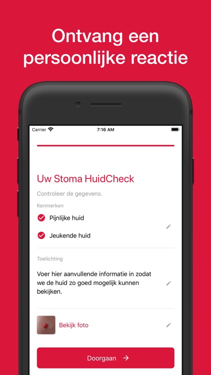 Stoma HuidCheck