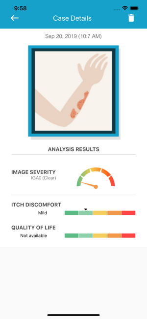 EczemaLess, an AI Eczema Guide(圖3)-速報App