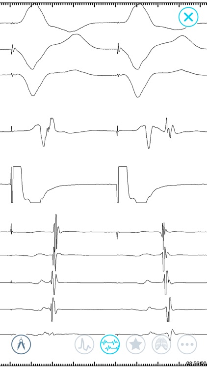 Cardiac Arrhythmia Challenge screenshot-4