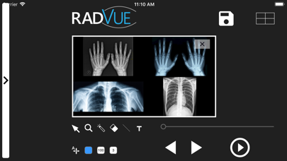RADVUE screenshot 3