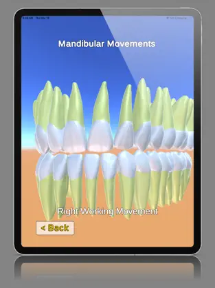 Captura de Pantalla 4 3D Tooth Anatomy iphone