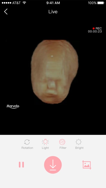 Fetus Camera