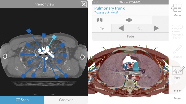Human Anatomy Atlas 2019 screenshot-3
