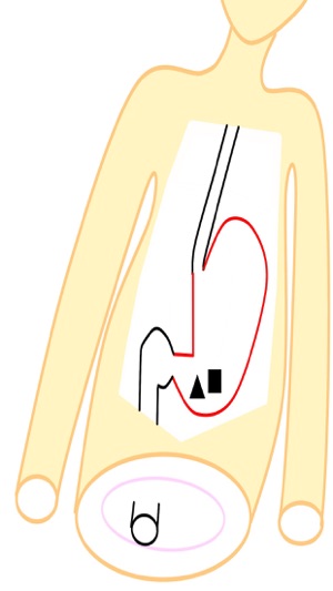 Drアニメ胃(Study Stomach)(圖2)-速報App