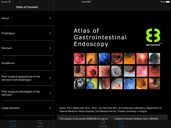 Screenshot #4 pour ENDO3®Atlas of GI Endoscopy HD