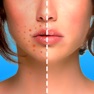 Get Blemish Editor - Face Tuner for iOS, iPhone, iPad Aso Report