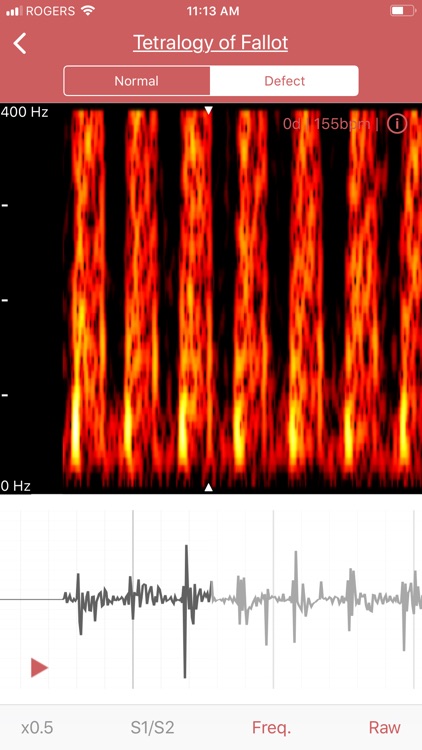 eMurmur Heartpedia screenshot-7