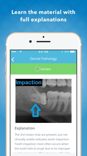 Dental Anatomy Mastery(圖3)-速報App