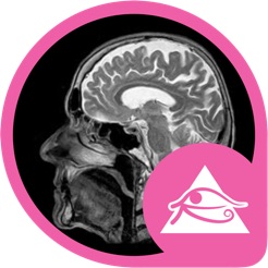 OSIRIX SCARICARE