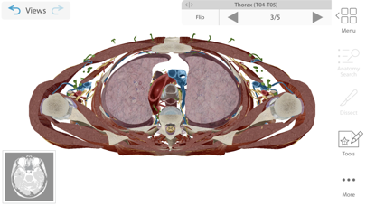 Human Anatomy Atlas 2021Screenshot of 5