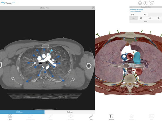 Human Anatomy Atlas 2021 Screenshots