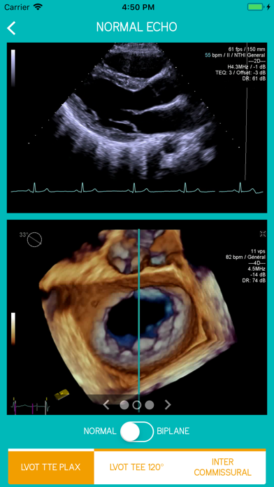 How to cancel & delete Mitral View from iphone & ipad 4