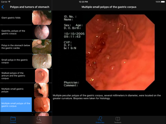 Screenshot #6 pour ENDO3®Atlas of GI Endoscopy HD