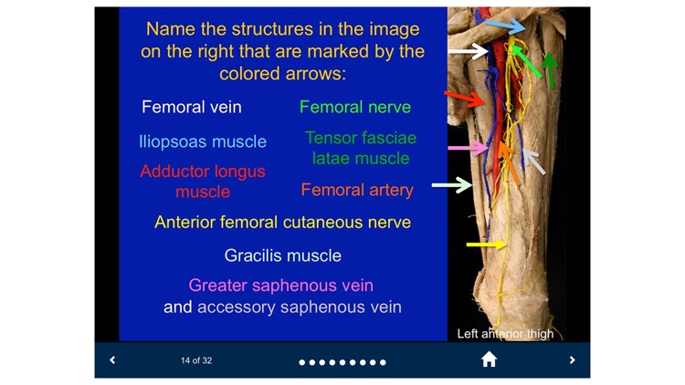 MSK Anatomy - SecondLook screenshot-3