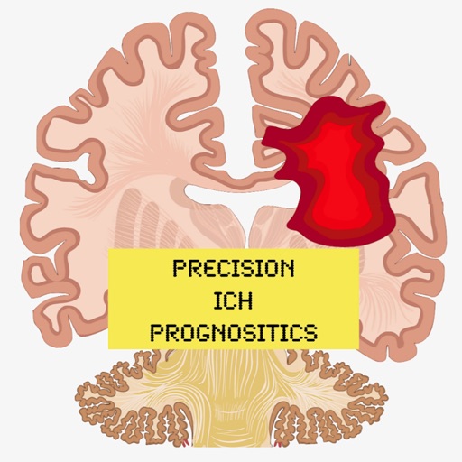 ICH Prognostics