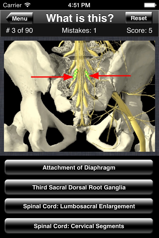 Anatomy Spine Quiz screenshot 3