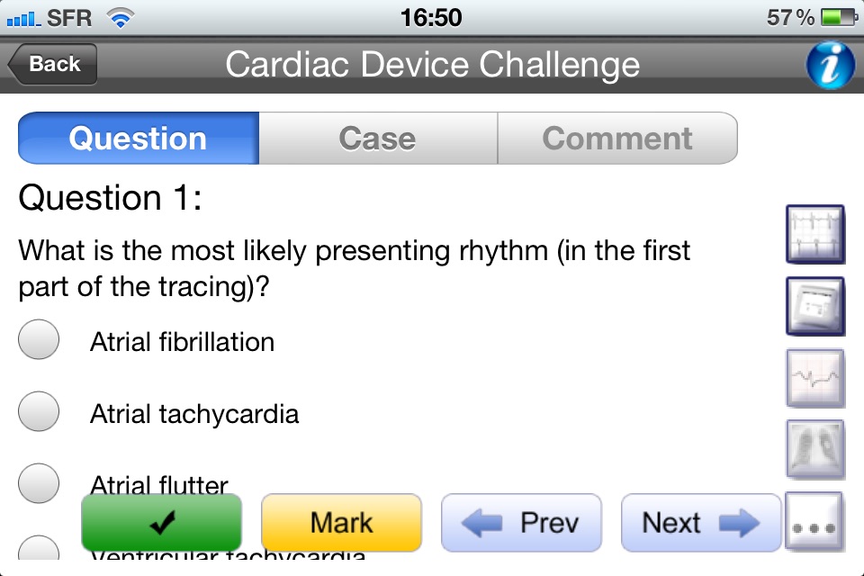 Cardiac Device Challenge screenshot 4