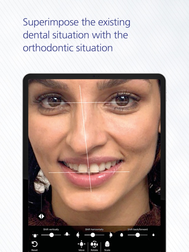 IvoSmile® Orthodontics on the App Store