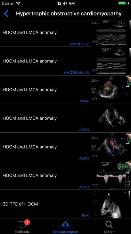 CARDIO3®Echocardiography