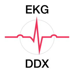 EKG DDX