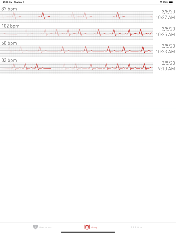 Cardiograph Heart Rate Monitor screenshot