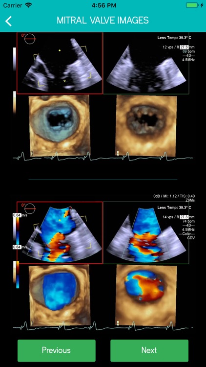 Mitral View screenshot-4