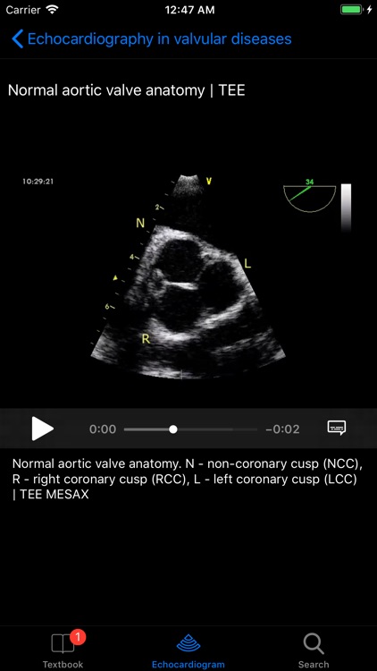 CARDIO3®Echocardiography