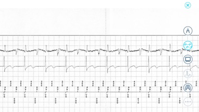 How to cancel & delete Cardiac Device Challenge from iphone & ipad 2