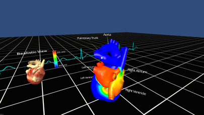 How to cancel & delete Living Heart for Cardboard VR from iphone & ipad 4