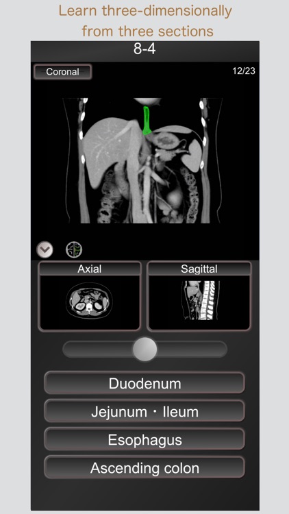 CT PassQuiz Abdomen / MRI