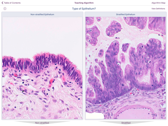 Ovarian Tumor Pathology screenshot 4