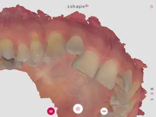 Screenshot 3 my3Shape para pacientes iphone