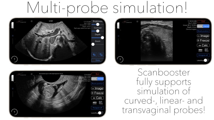 Scanbooster Ultrasound Sim screenshot-4