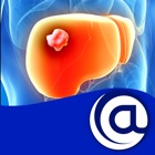 Top 18 Medical Apps Like Hepatocellular Carcinoma @PoC - Best Alternatives