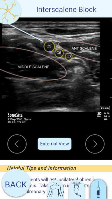 Nerve Block Star App screenshot 4