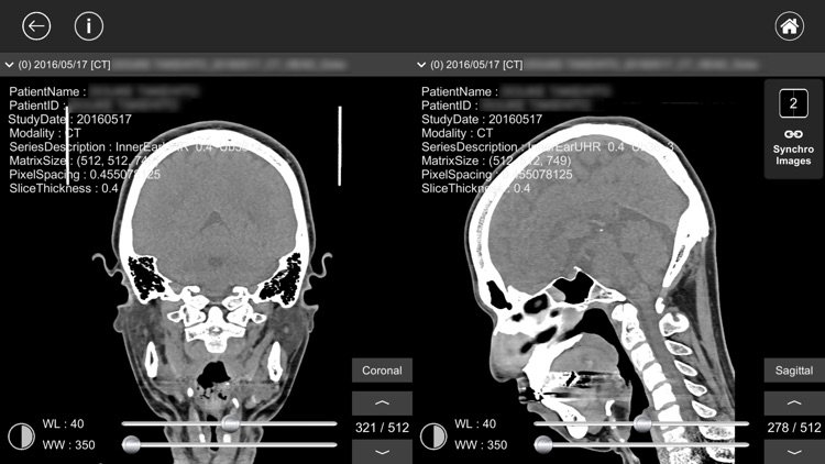 DICOM Viewer : eMma screenshot-4