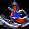 Unique to EchoLab among echocardiography applications is the powerful Analytic Engine, which synthesizes results from multiple calculations into a cohesive overview with a comprehensive summary, with integration of 2015 ASE/EACVI cardiac chamber quantification guidelines and 2014 ACC/AHA guidelines for valvular heart disease