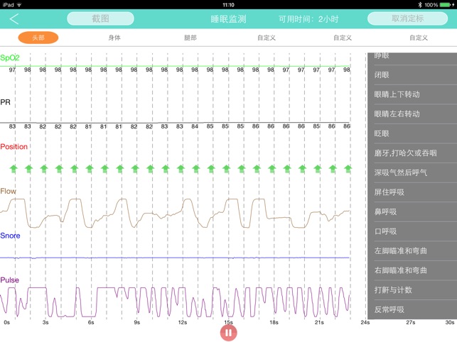 BMC PolyHub(圖3)-速報App