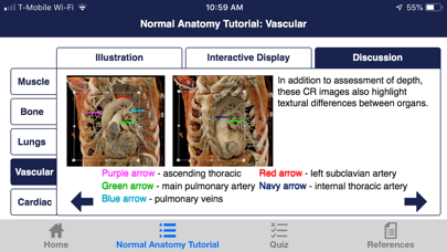 CTisus Chest Atlas 3D CRT screenshot 4