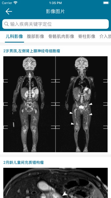 临床精钥ClinicalKey