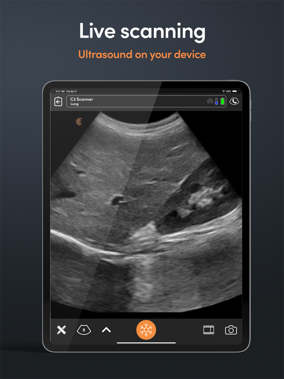 Clarius Ultrasound App screenshot 2