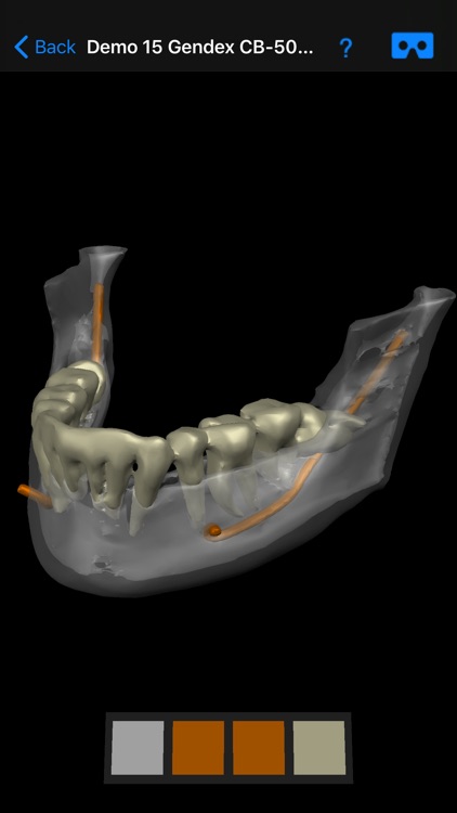 Dental CT View screenshot-8