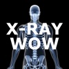 X-Ray Wow