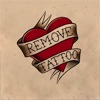 Remove Tattoo