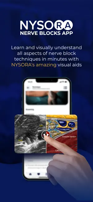 Captura de Pantalla 2 NYSORA Nerve Blocks iphone
