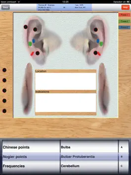 Game screenshot AcupunctureEN apk