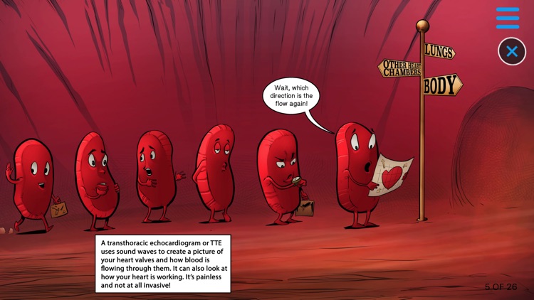 Aortic Stenosis Xplained