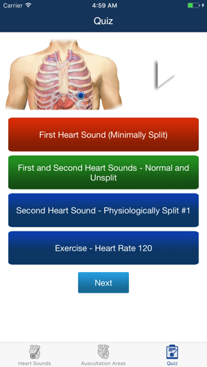 Heart Sounds Auscultation & Quiz(圖5)-速報App