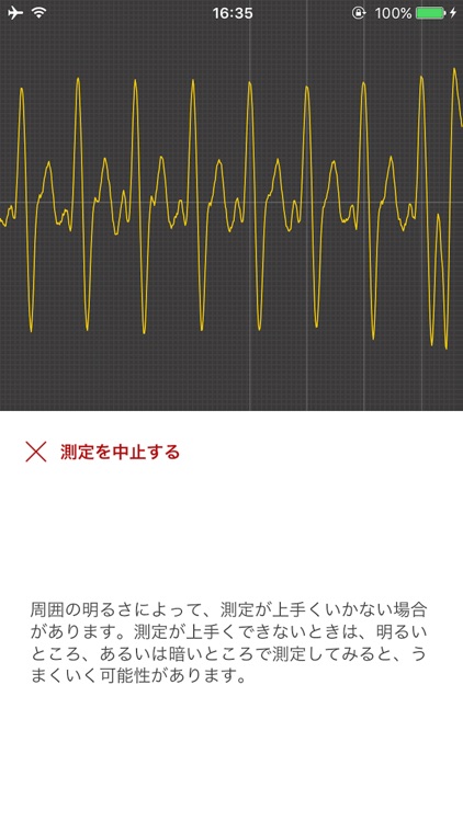 血管年齢測定
